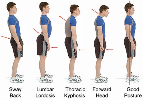 Posture alignment dashboard showing daily correction points and progress tracking across body zones
